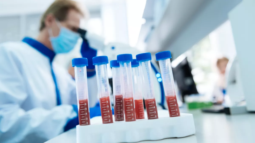 blood_test_759427315