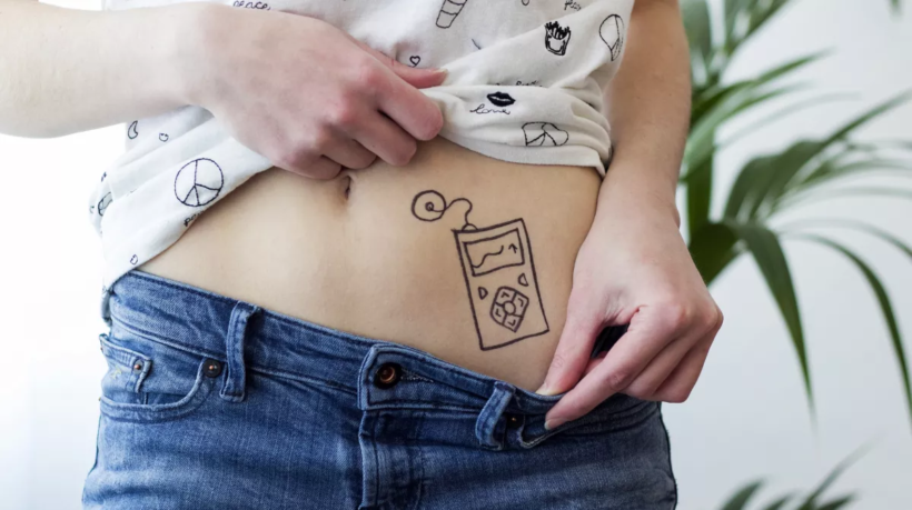 insulin_pump_2101107997