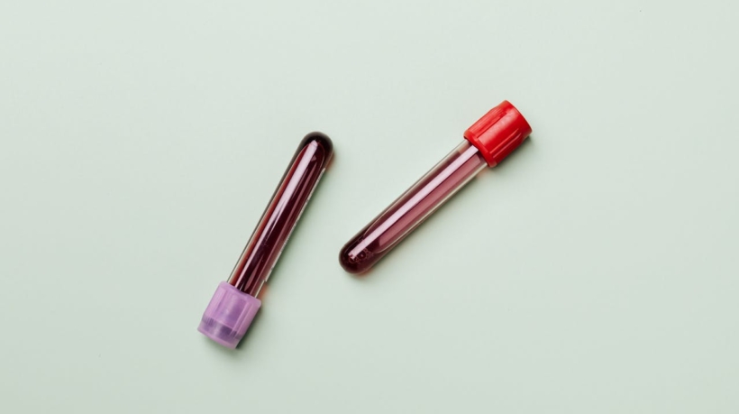 Αιμορροφιλία